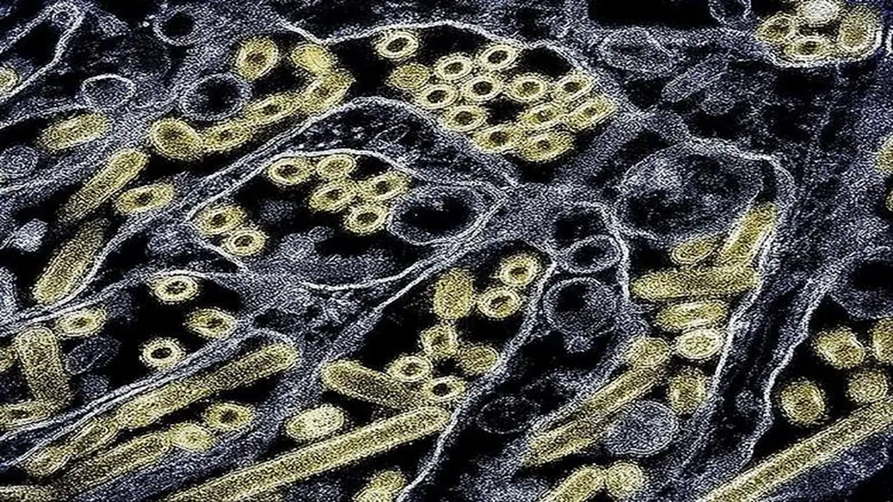 شهادة شفاء جديدة تُثري أبحاث فيروس نقص المناعة البشرية بعد زراعة خلايا جذعية ناجحة